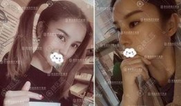 整形手术爆料视频,真实爆料视频曝光全过程